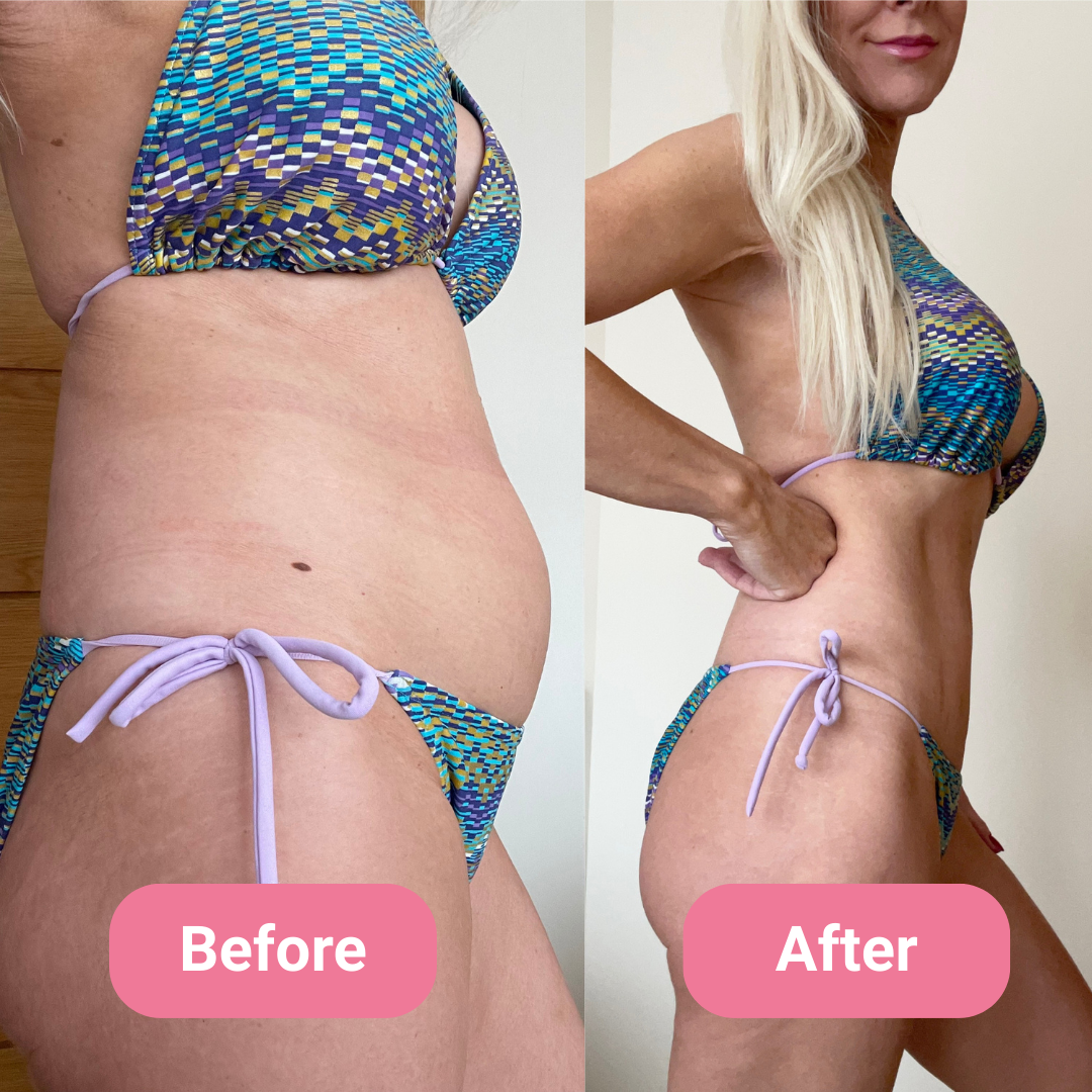 Side-by-side comparison of a woman in a bikini labeled 'Before' and 'After.'