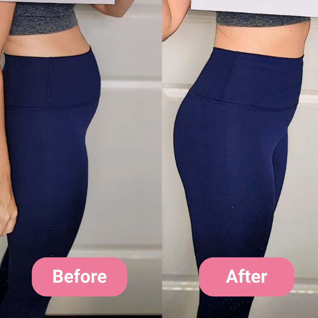 Side-by-side comparison of a person in leggings labeled 'Before' and 'After.'