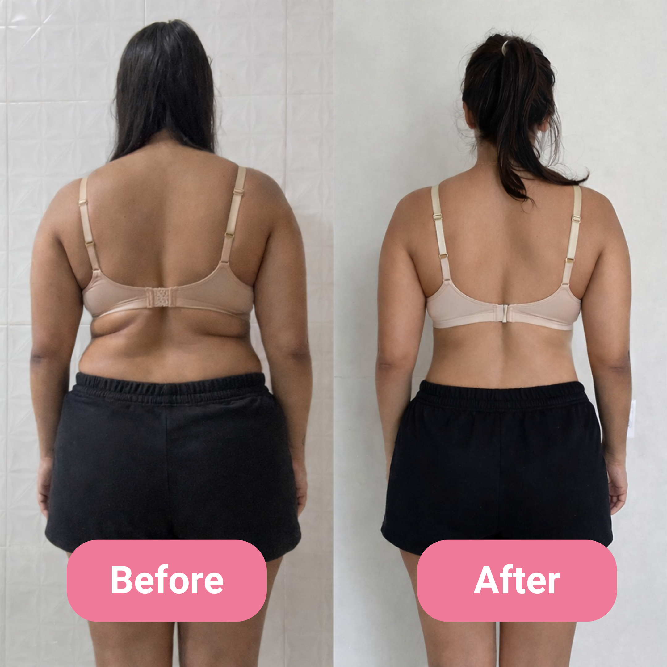 A before and after comparison showing the back of a woman who has lost weight.
