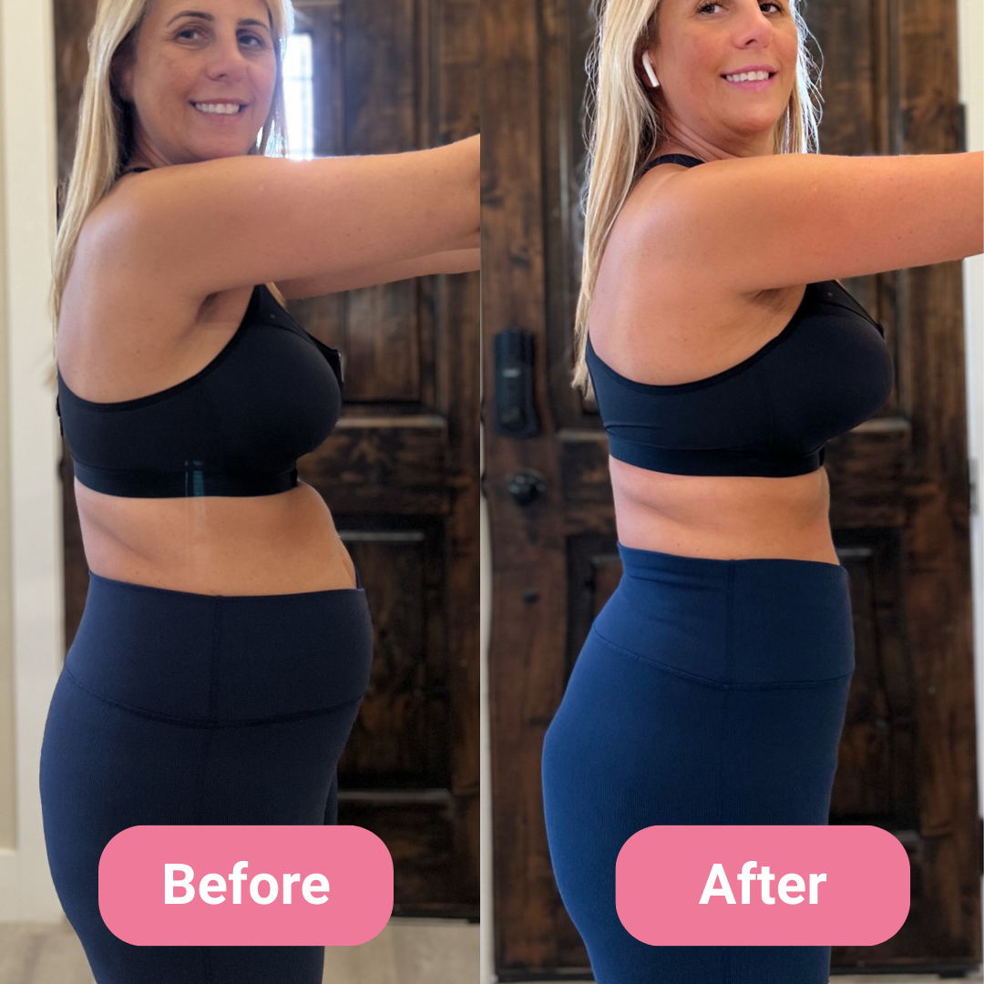 Side-by-side comparison of a woman before and after weight loss.