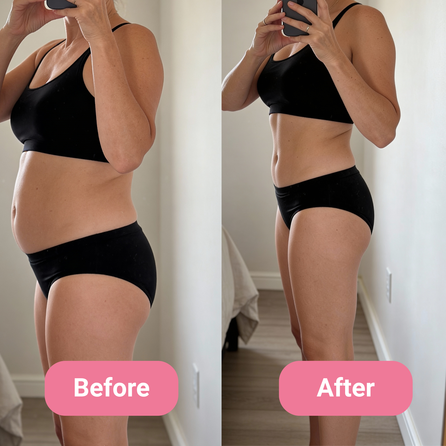 Side-by-side comparison of a woman before and after weight loss.