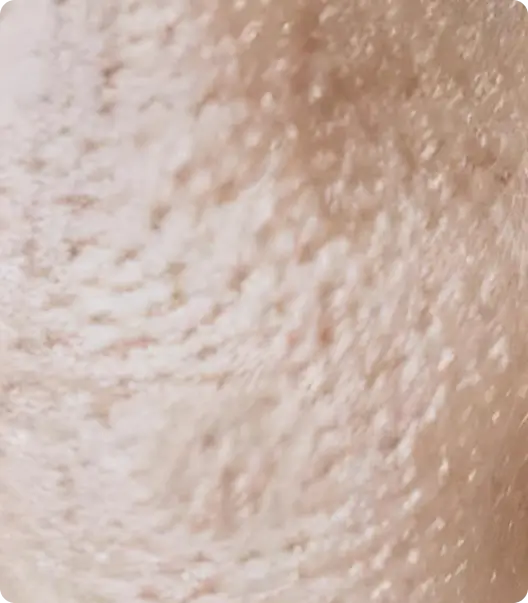 Close-up of textured skin with visible pores and fine lines.