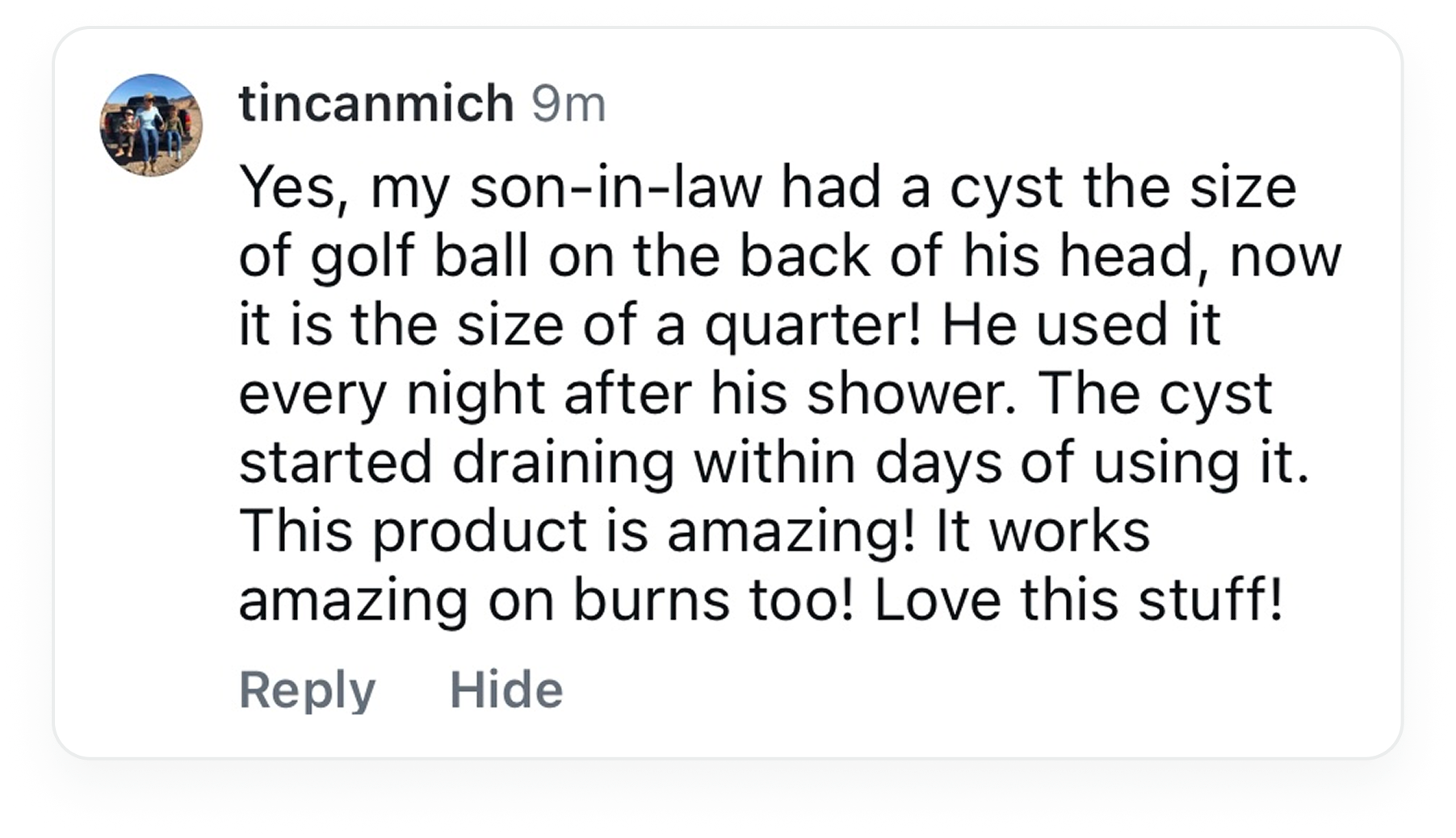 A social media comment from user 'tincanmich' praising a product's effectiveness on a cyst and burns.