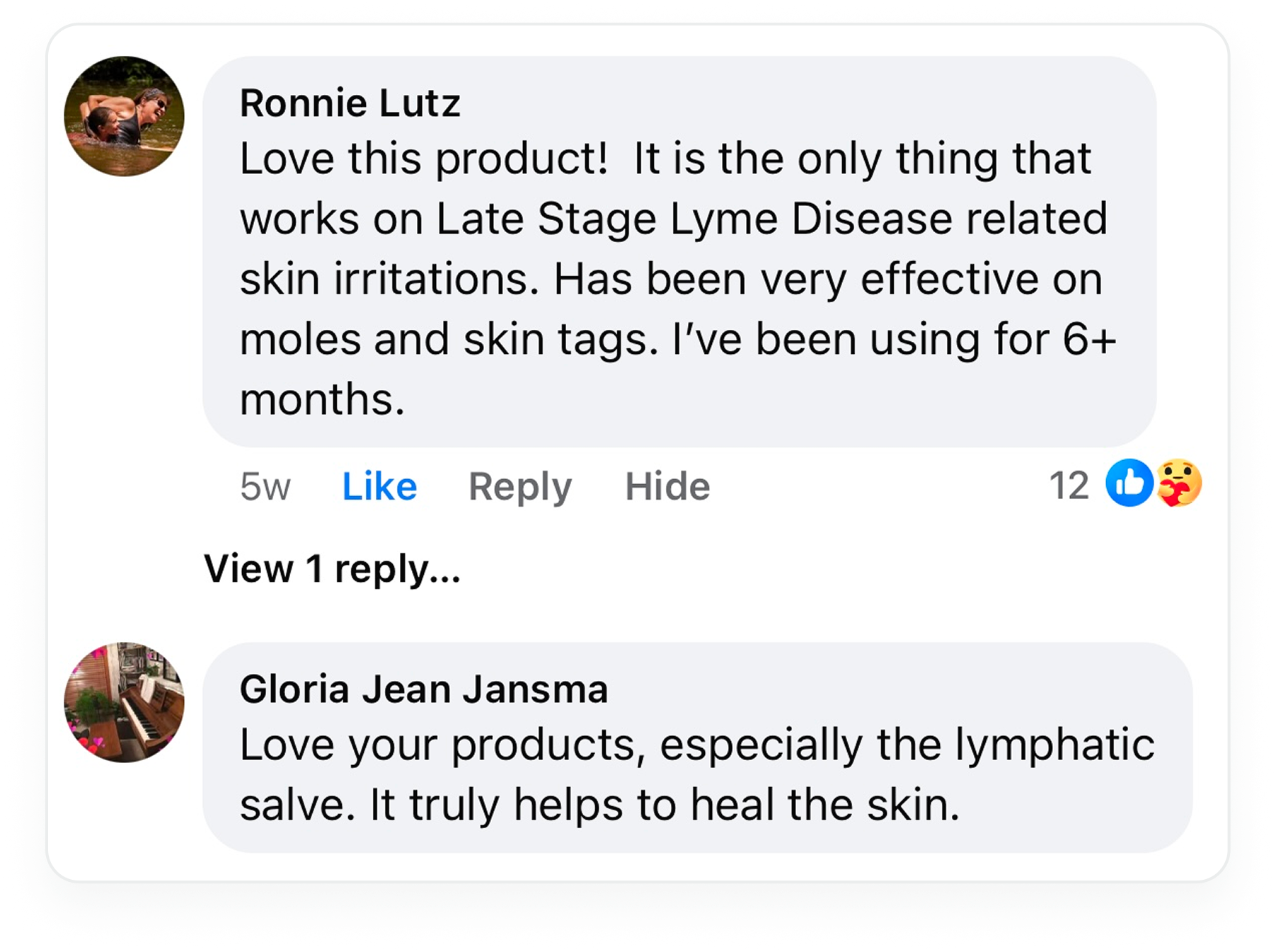 A screenshot of two positive customer testimonials on social media for a product that helps heal the skin.