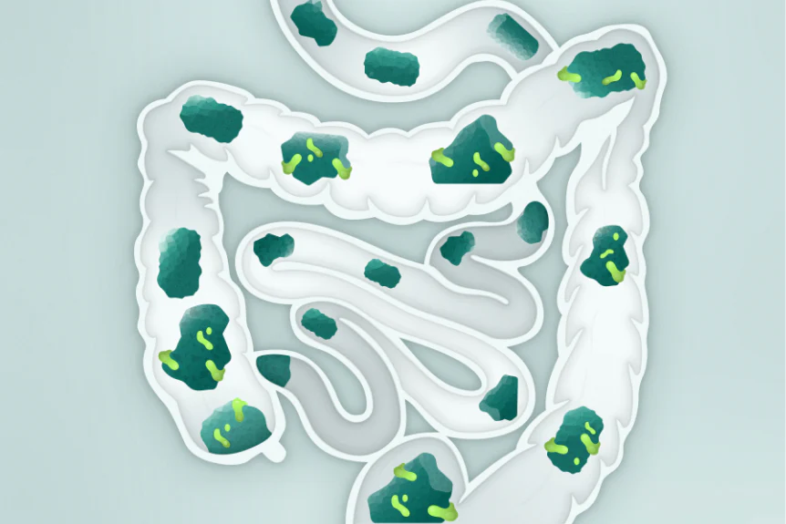 Illustration of intestines with green spots inside.