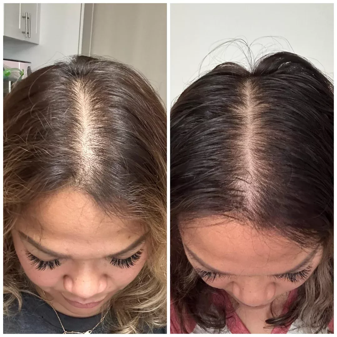 Before and after comparison photos showing a woman's hair part looking fuller and darker on the right.