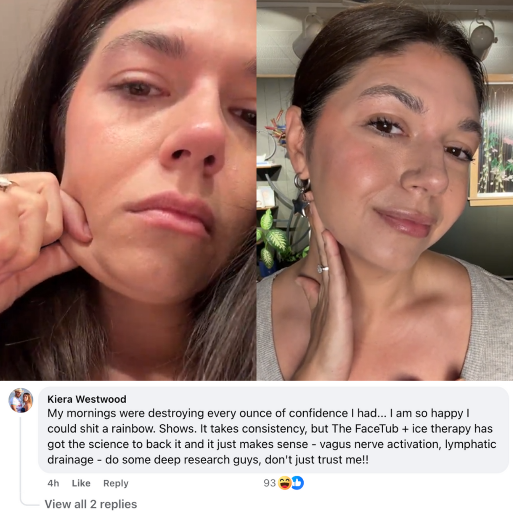 Two images side by side of a woman touching her face, captioned with a personal comment.