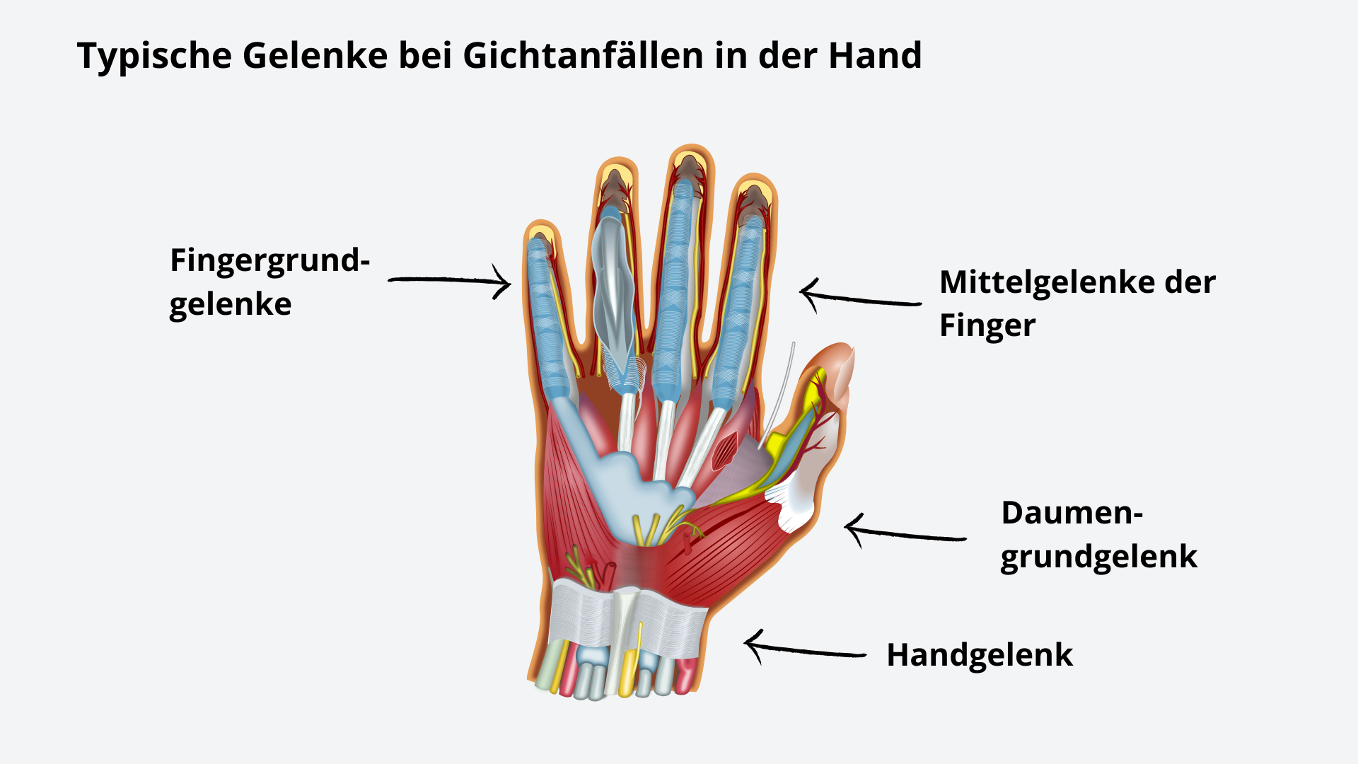 Anatomical diagram of hand joint structures labeled in German.