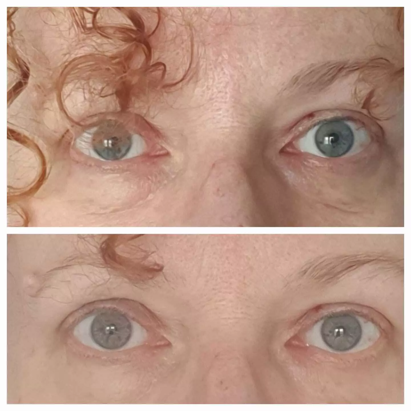 Close-up of a person's eyes with curly hair visible.