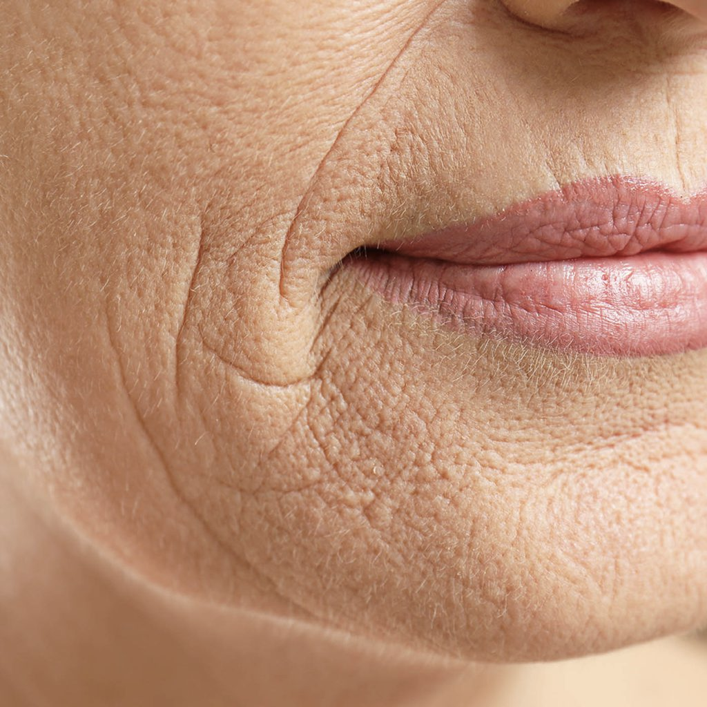 Close-up of a person's wrinkled skin near the mouth.