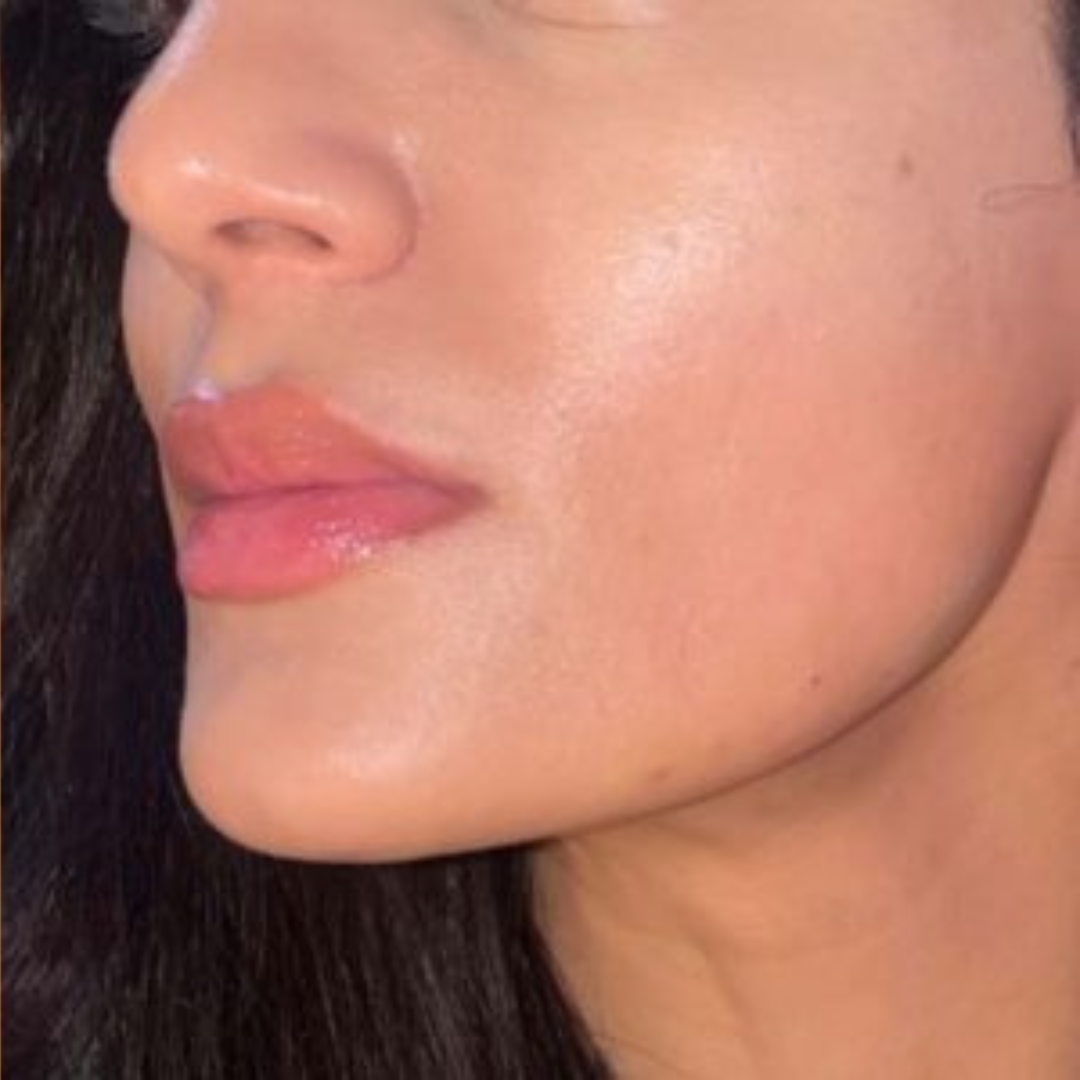 Close-up of a person's face showing lips and cheek.