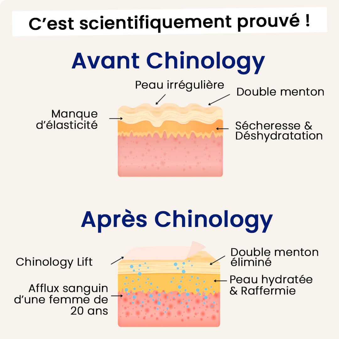 A before-and-after infographic in French showing the effects of a product called Chinology on skin layers.