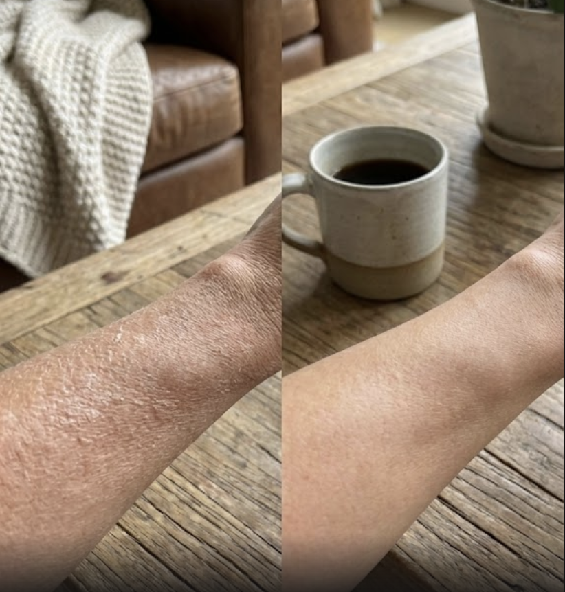 Split image showing a dry and moisturized arm on a wooden table.