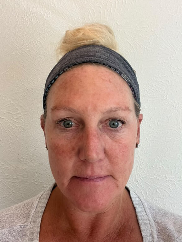 Person wearing a headband, looking directly at the camera against a plain background.