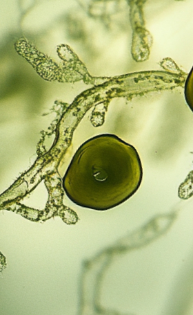 Microscopic view of an algal cell with branching filaments.