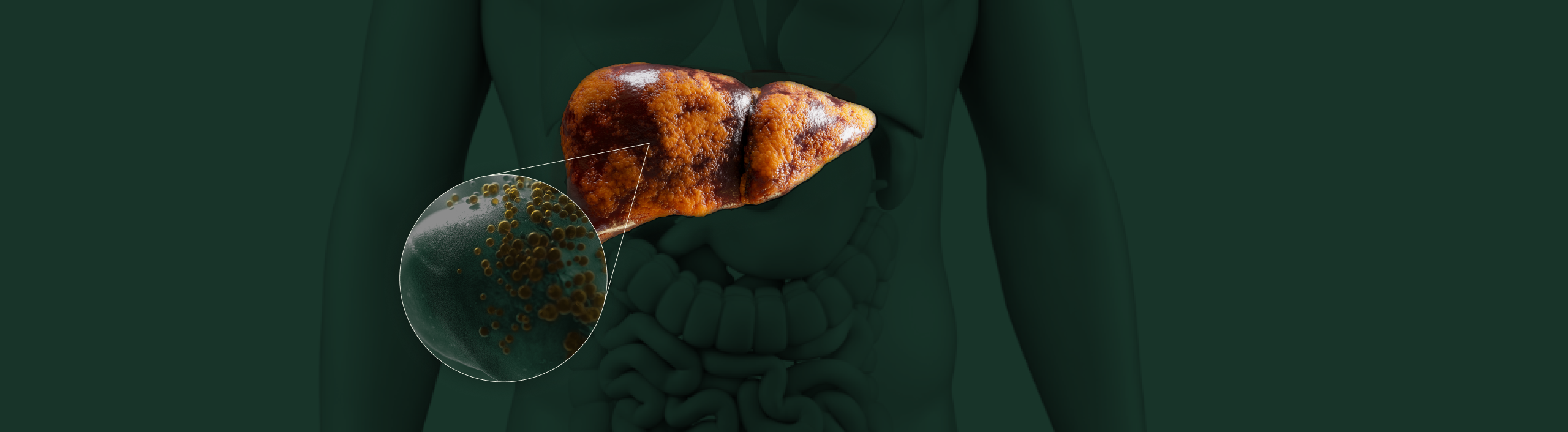 Illustration of a liver with a zoomed-in view of cells.