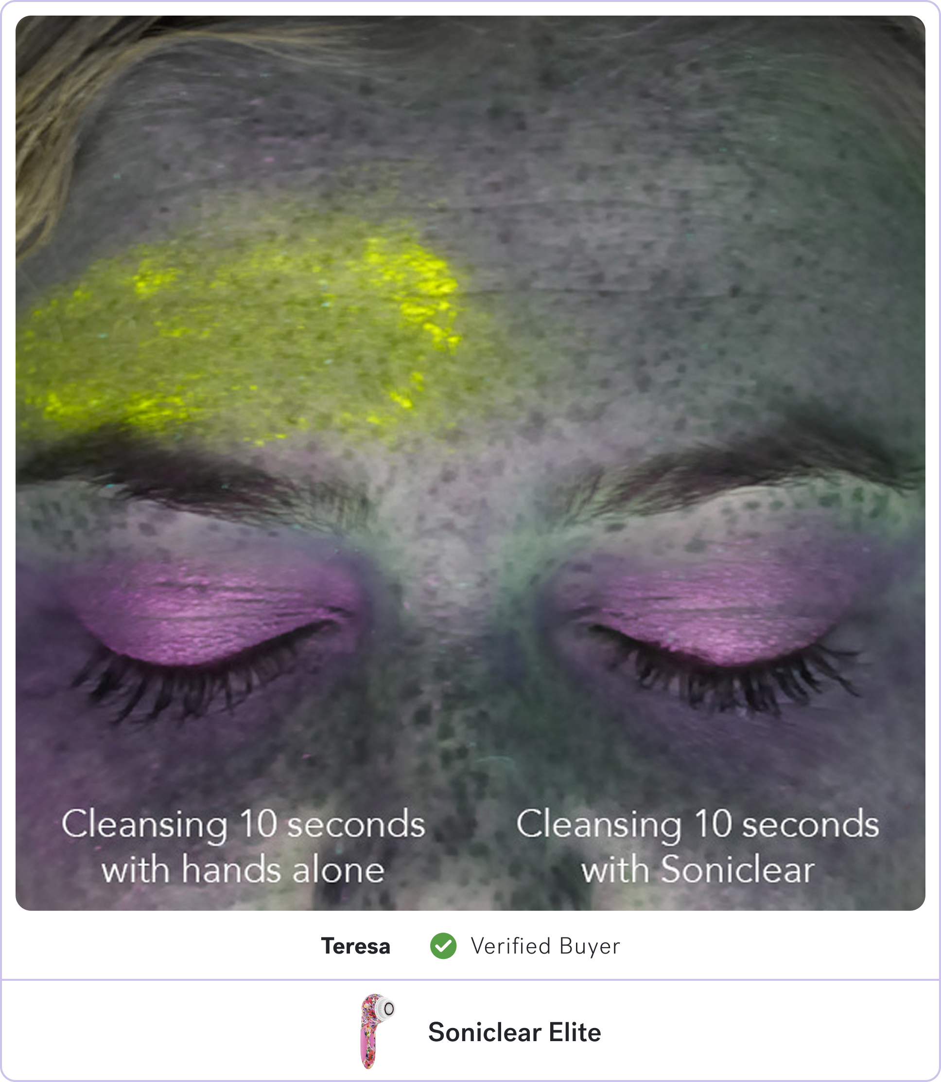 Comparison of cleansing with hands versus using a Soniclear, showing differences on a model's forehead.