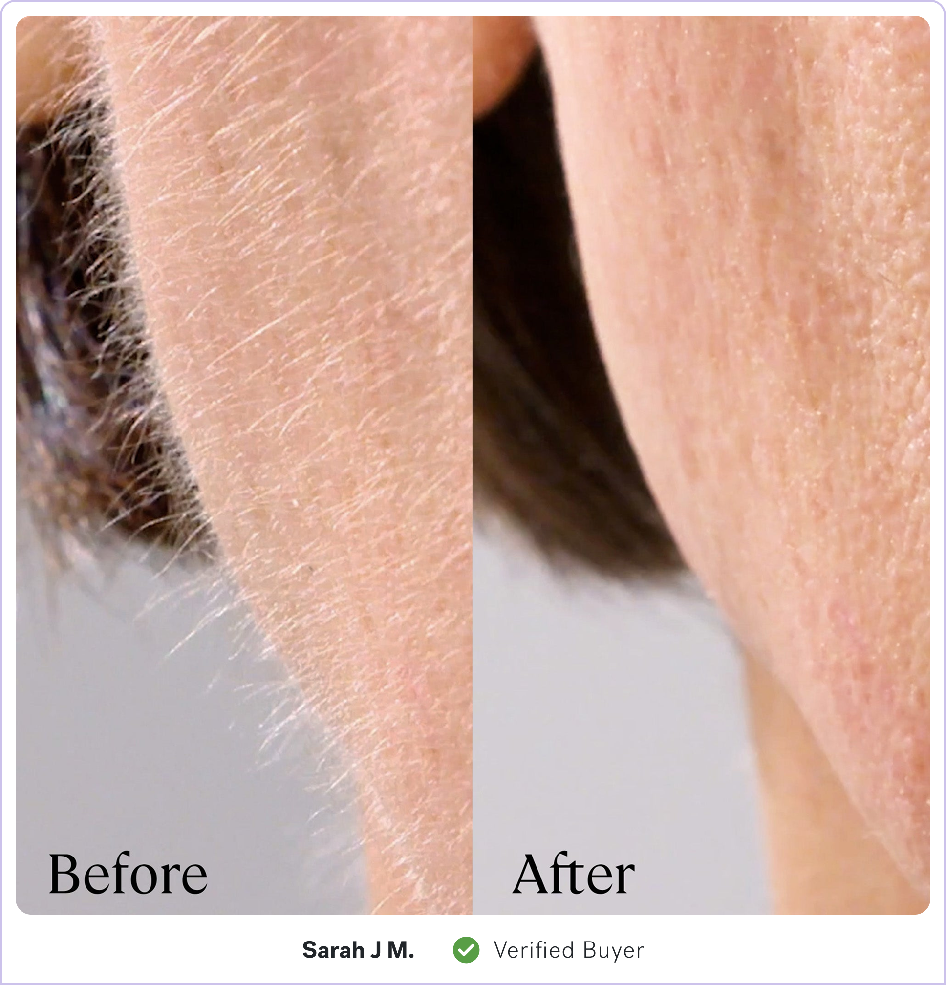 Side-by-side comparison of skin before and after treatment.