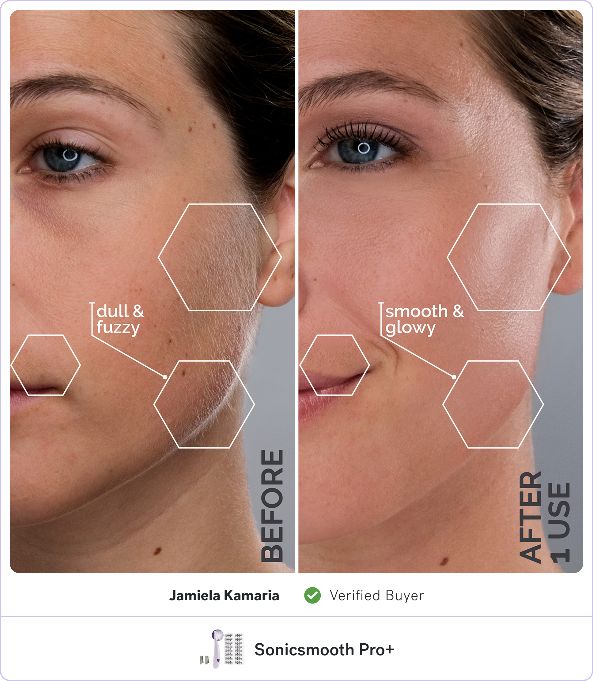 Split image showing facial skin before and after SonicSmooth Pro+ use.