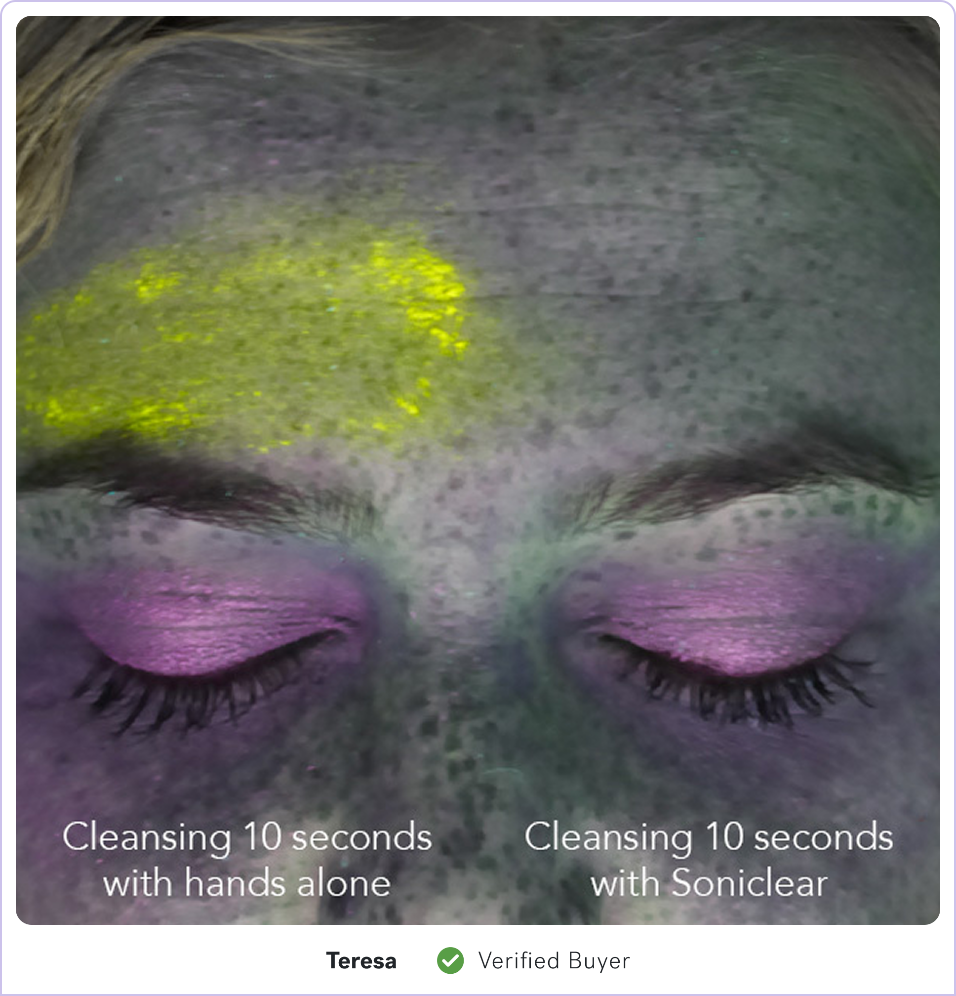 Comparison of cleansing methods on forehead with yellow highlight.
