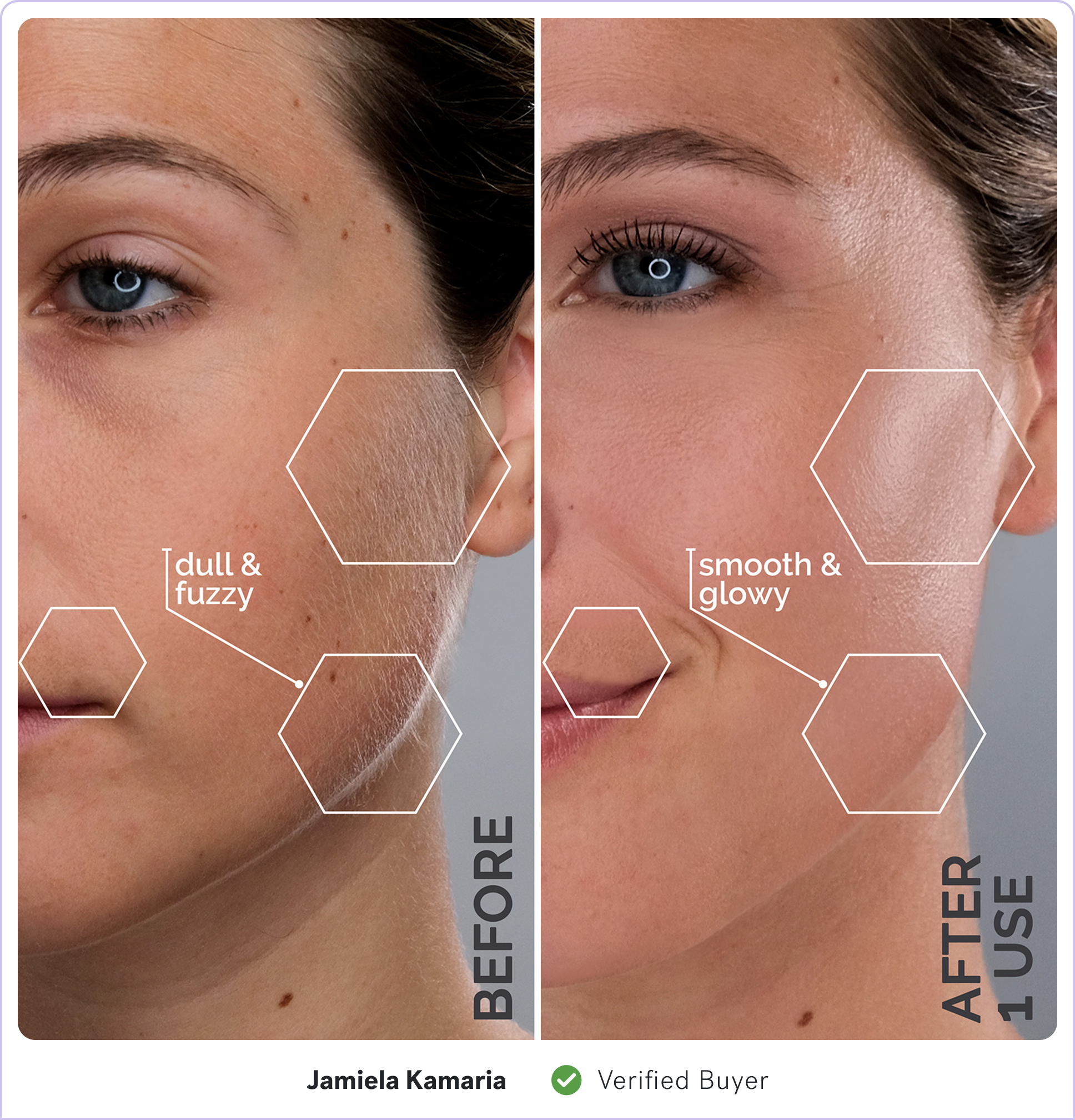 Before and after images of skin showing texture changes, labeled 'dull & fuzzy' and 'smooth & glowy.'