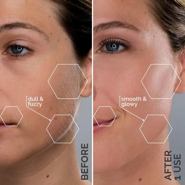 Side-by-side comparison of skin texture before and after treatment.