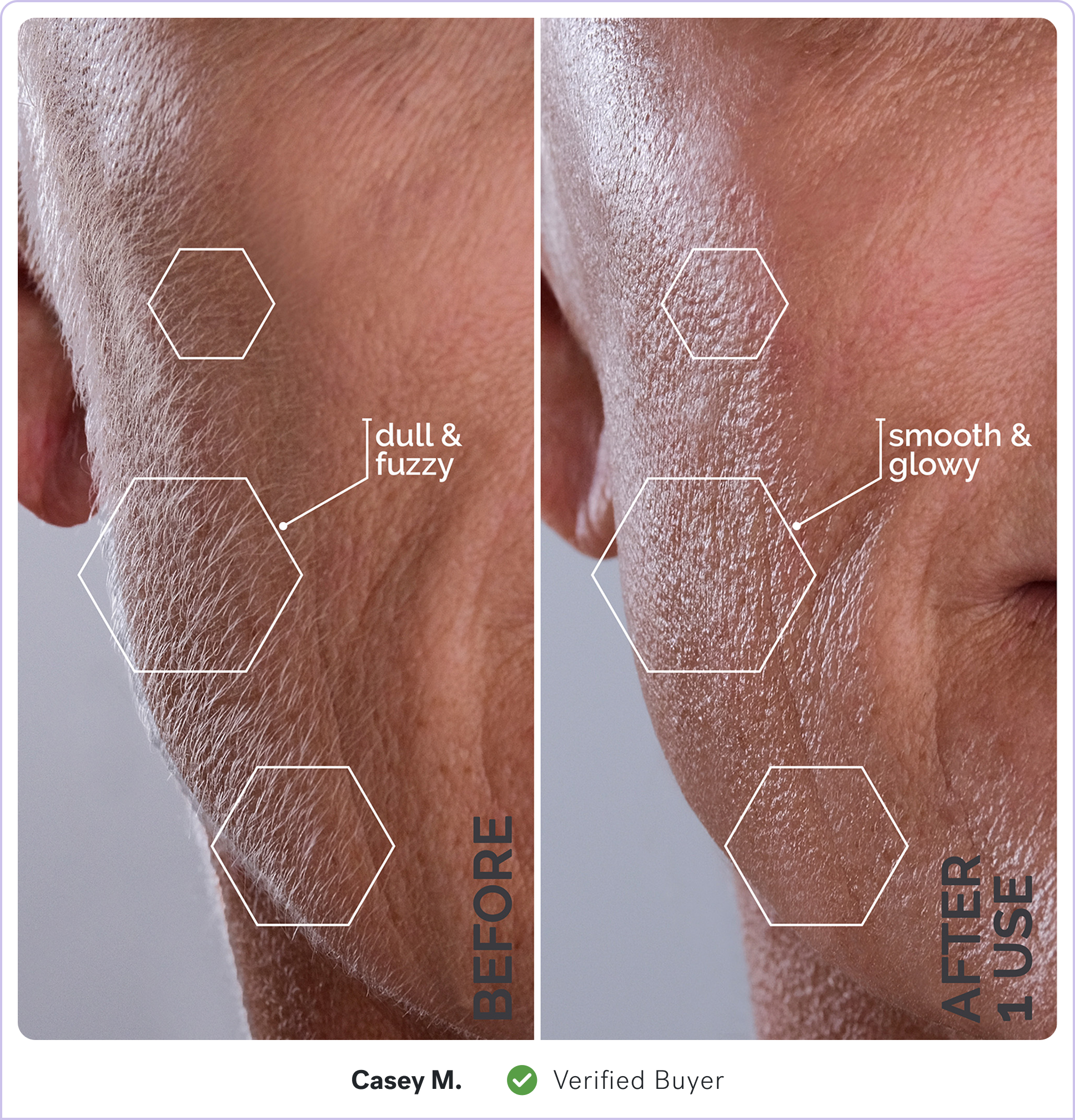 Comparison of skin texture before and after product use; labeled 'dull & fuzzy' and 'smooth & glowy'.