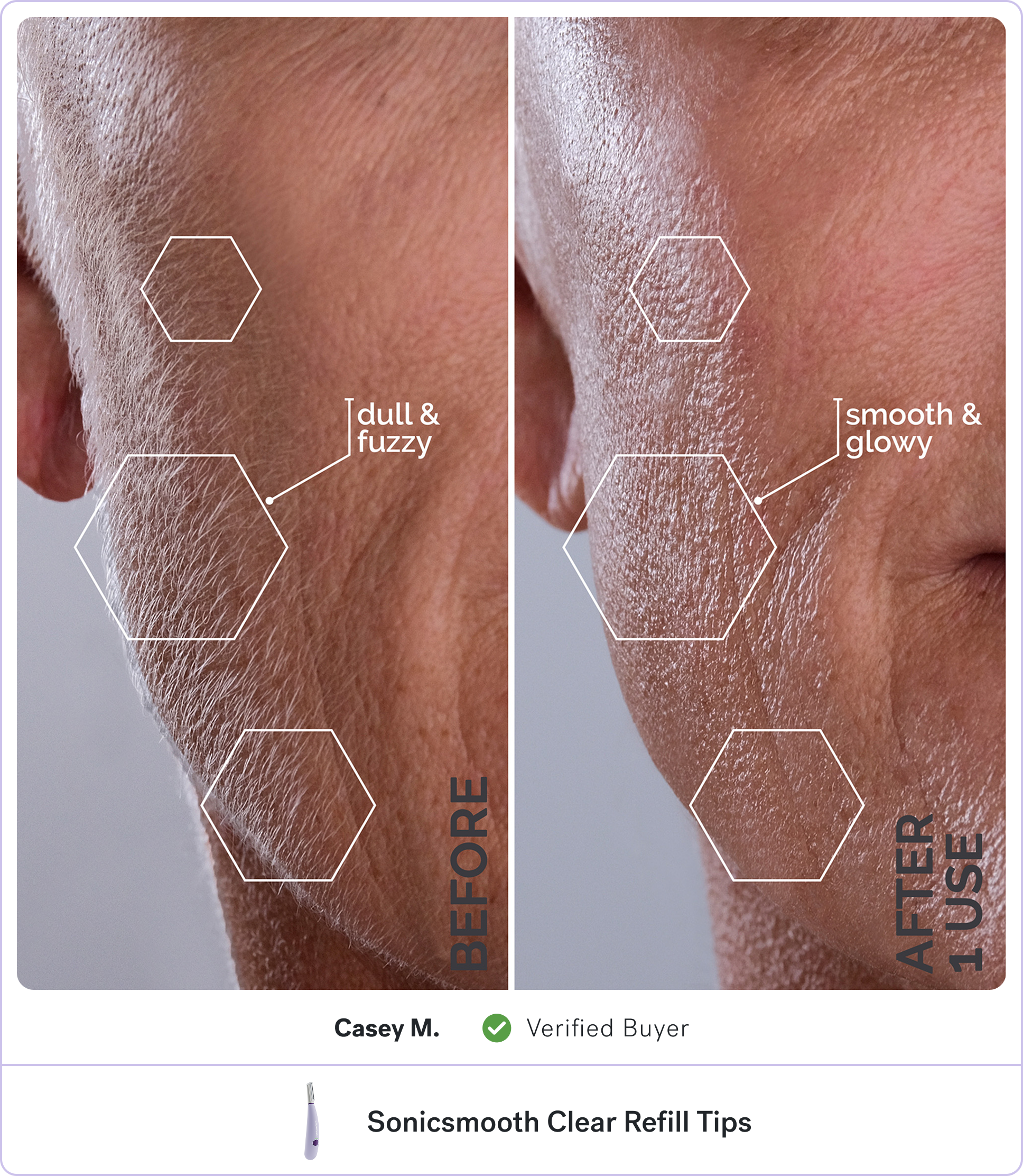 Before and after images showing skin improvement, labeled 'dull & fuzzy' and 'smooth & glowy.'