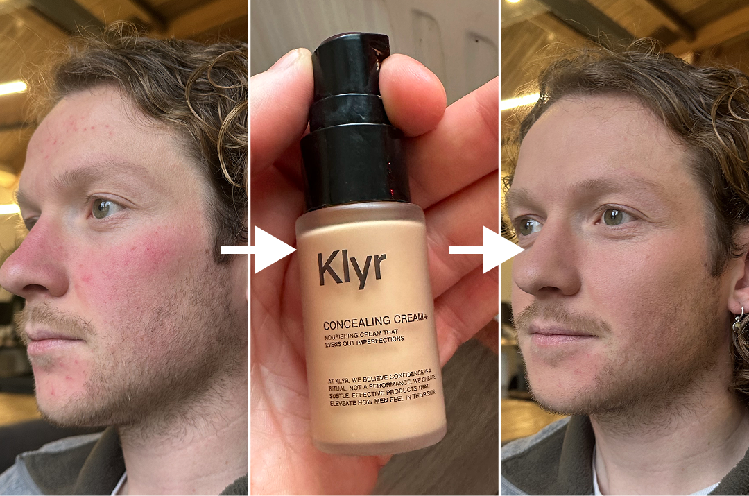 A before-and-after image of a man's face, showing reduced redness after using Klyr concealing cream.