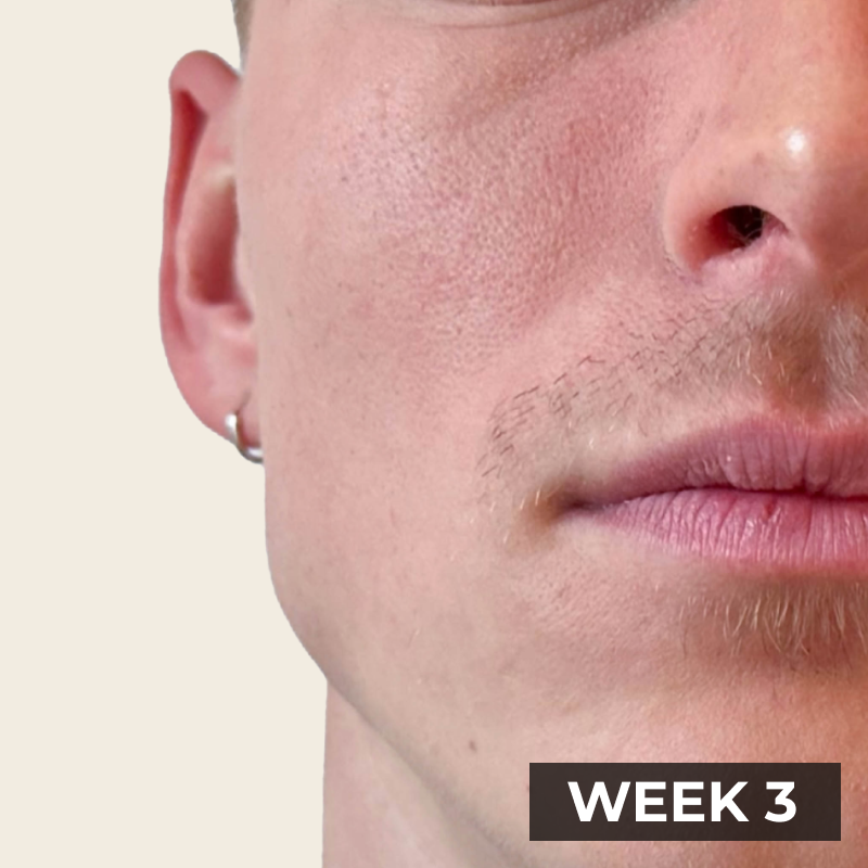 A close-up of a man's face showing sparse mustache growth, with a label in the corner reading 'WEEK 3'.
