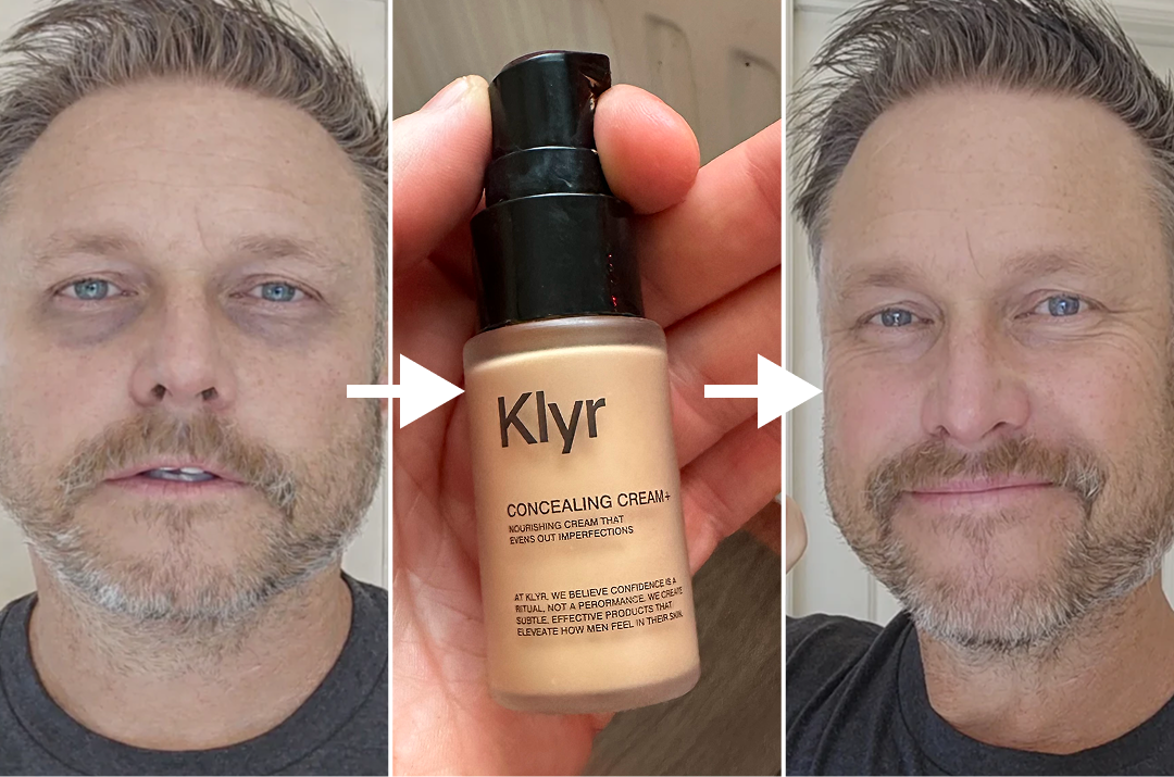 A before-and-after image of a man using Klyr concealing cream to reduce dark under-eye circles.