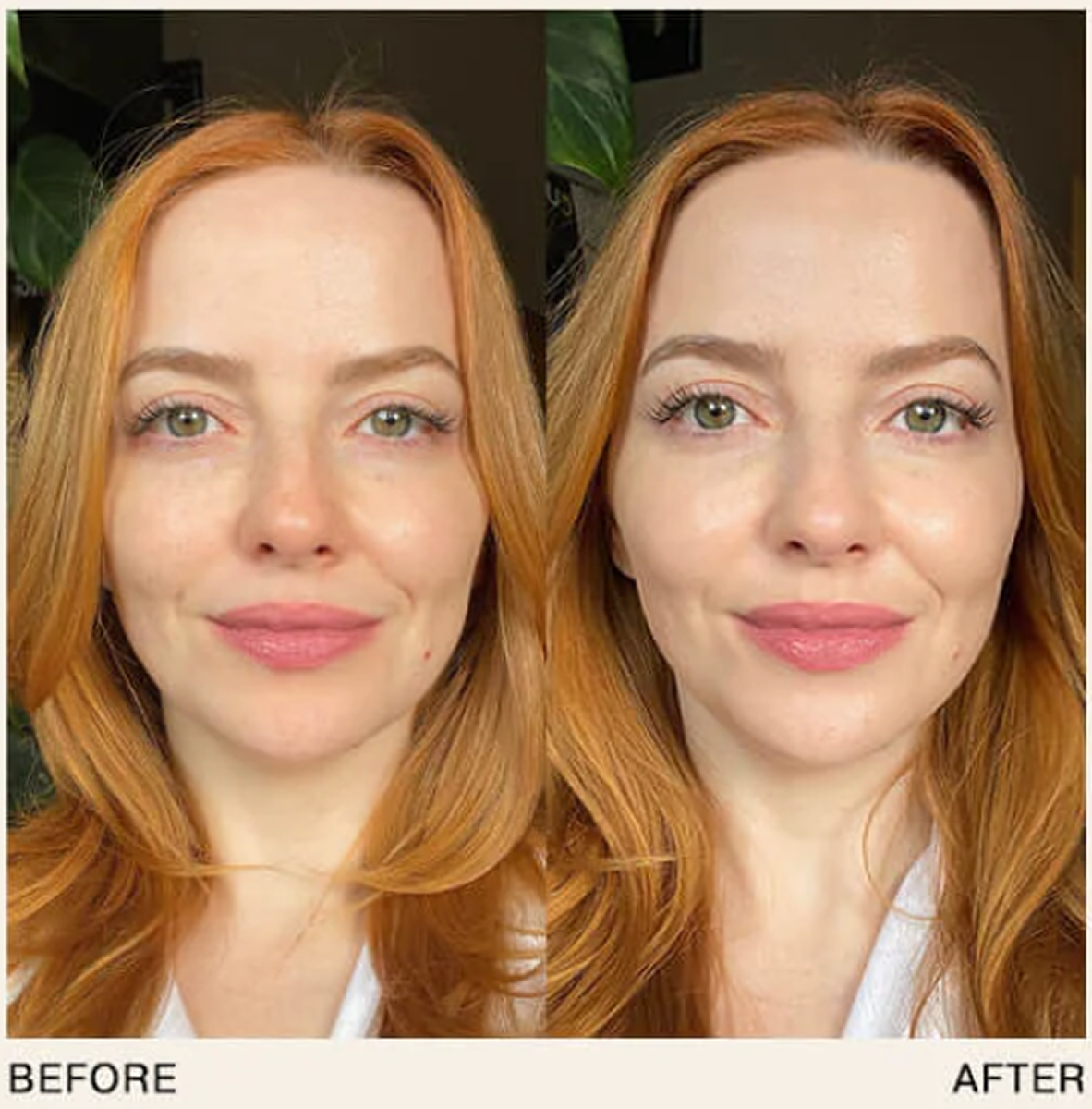 Side-by-side comparison of a woman's face labeled 'Before' and 'After.'