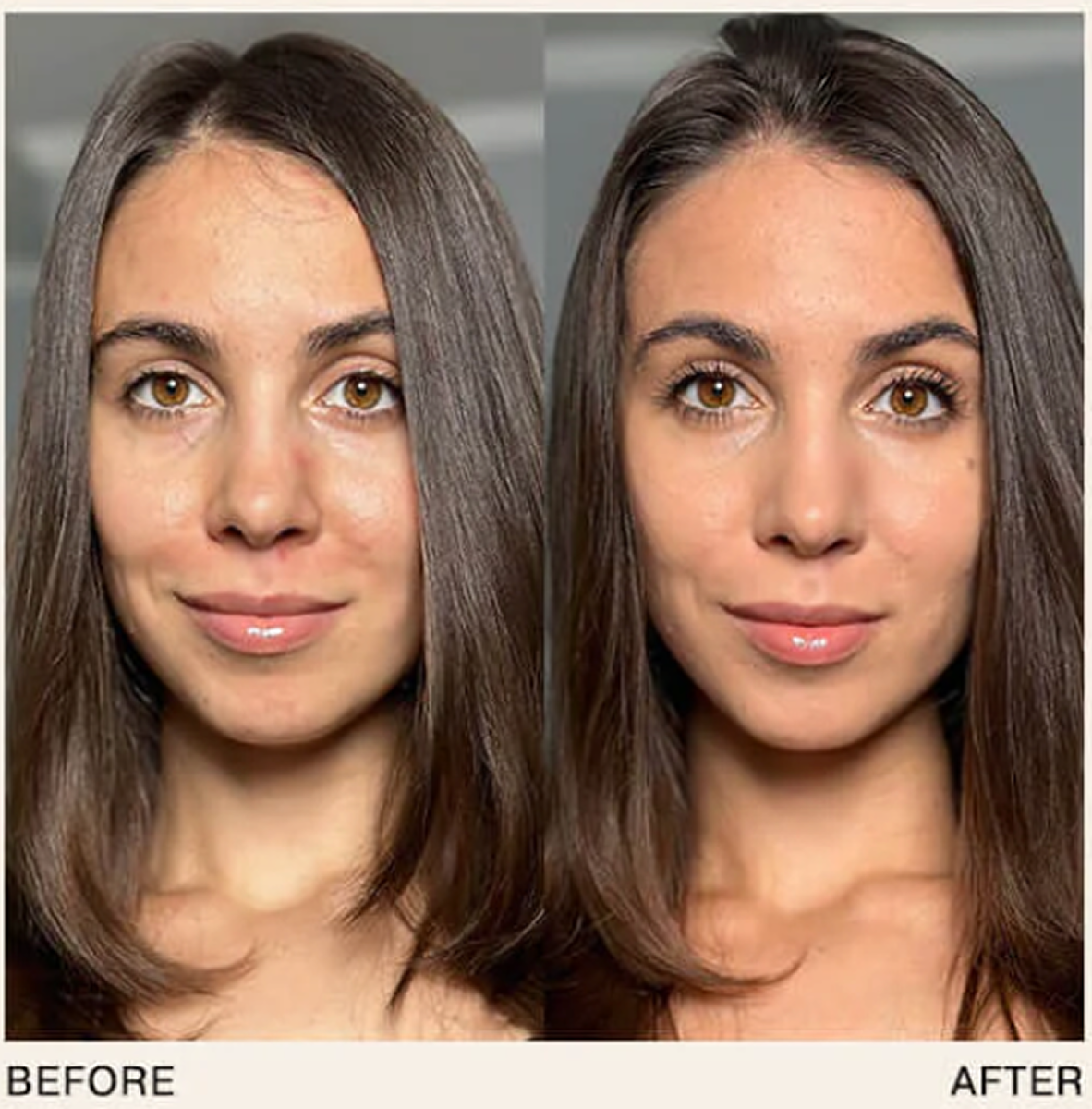 Side-by-side comparison of a woman's face labeled 'Before' and 'After.'