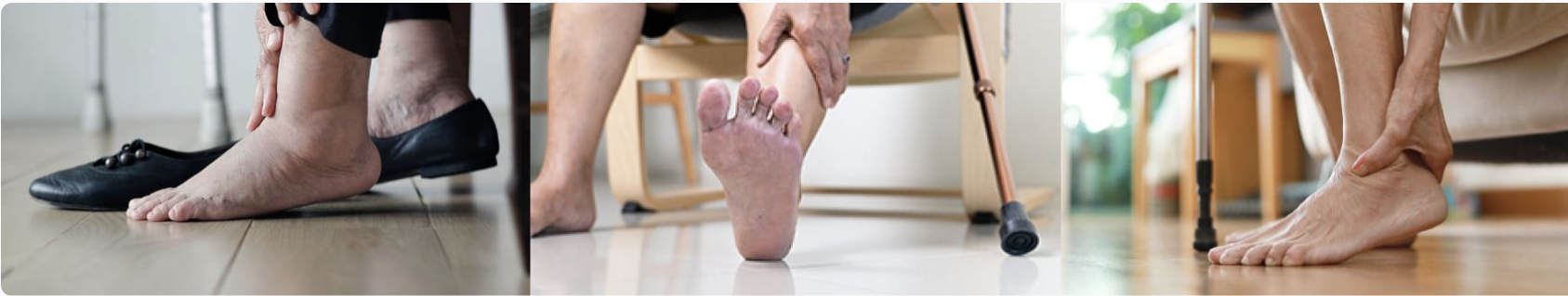 Three images of feet, one with a shoe, one bare, and one with a cane.