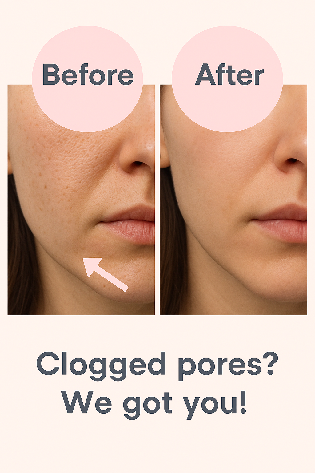 Before and after comparison of skin with text about clogged pores.