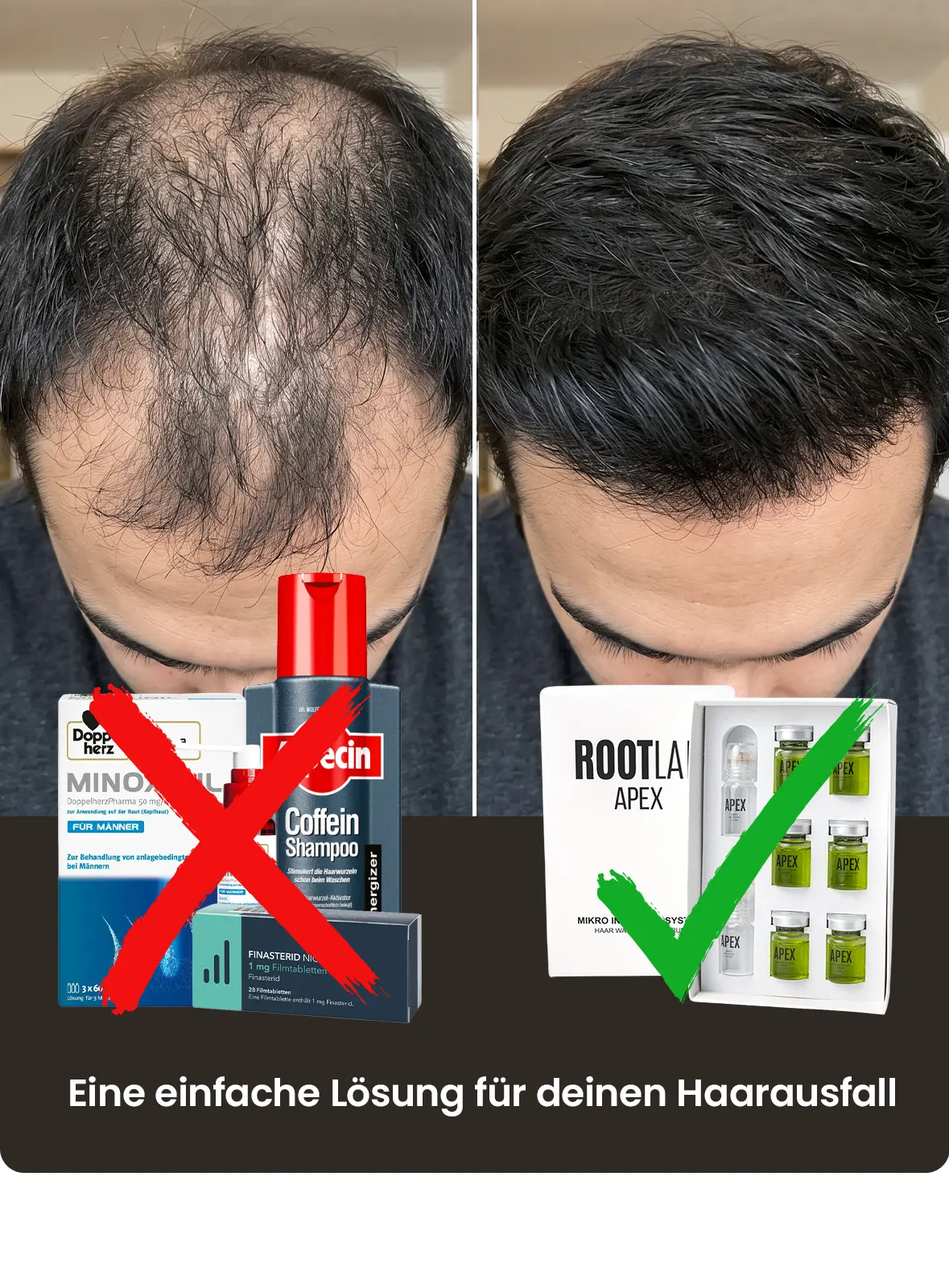 A before-and-after photo of a man's hair, comparing the results of different hair loss products.