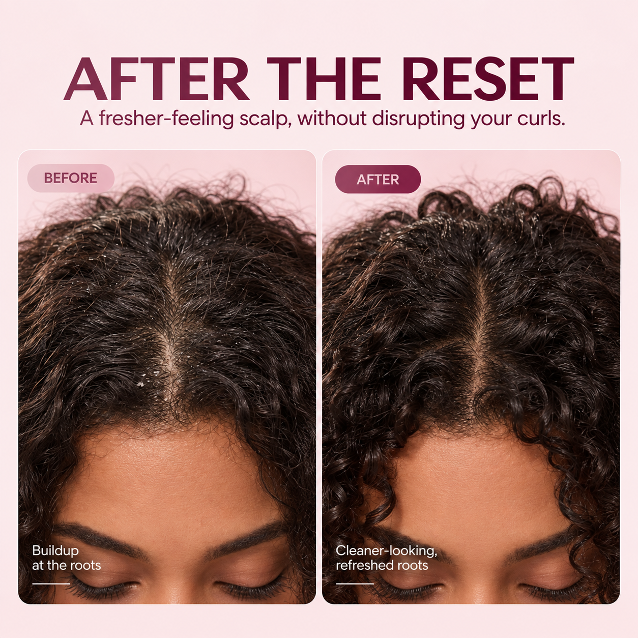 A before-and-after image showing the top of a woman's head, first with scalp buildup, then clean.