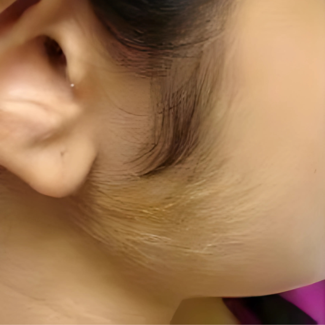 Close-up of a person's ear and side of the face.