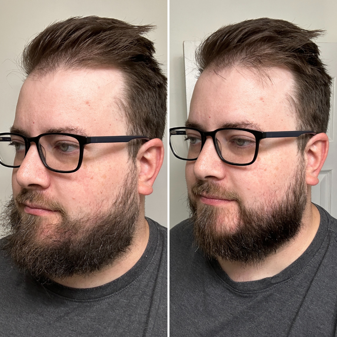 Side-by-side comparison of a man with glasses and a beard.