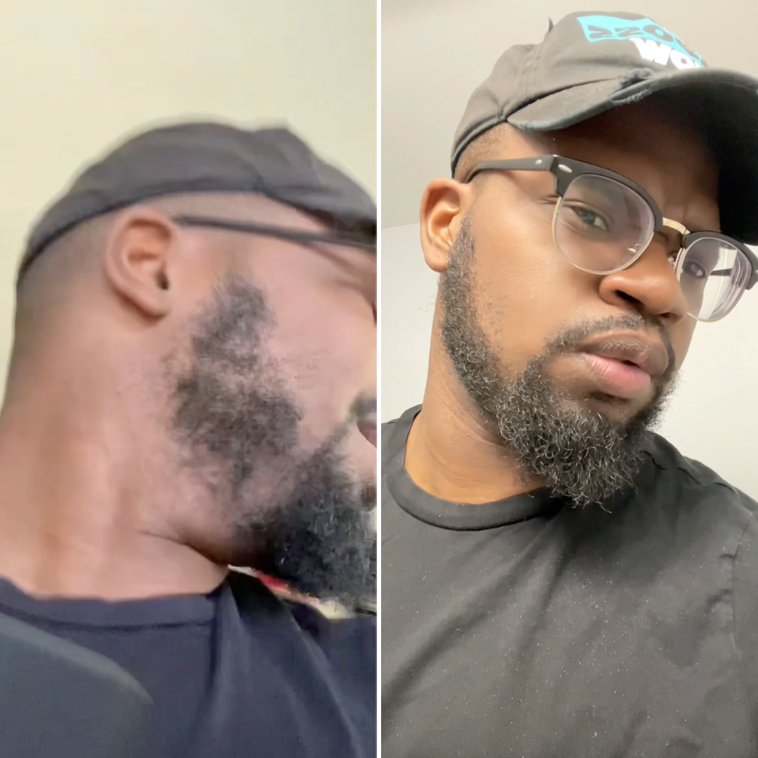 Split image of a man wearing glasses and a cap, looking sideways.
