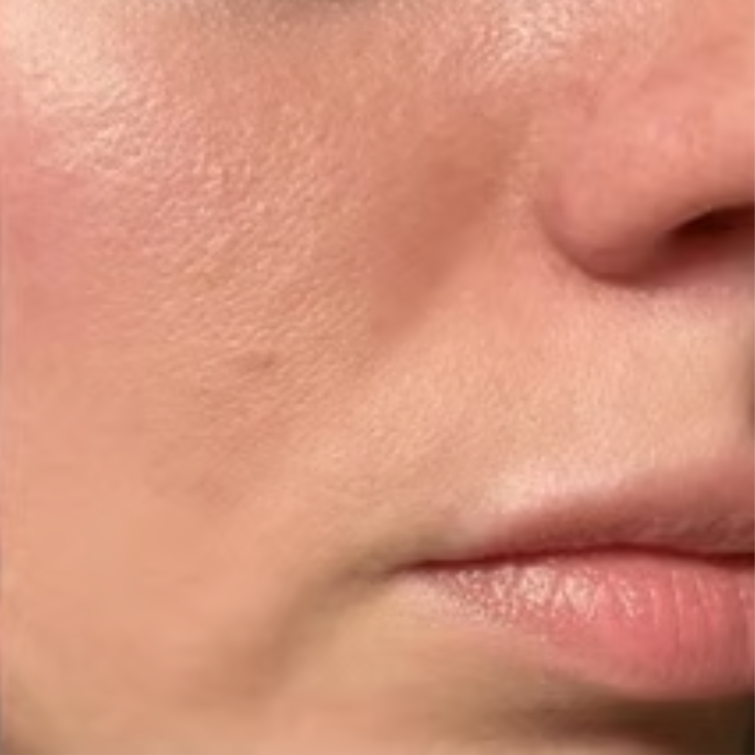 Close-up of a person's cheek and lips.