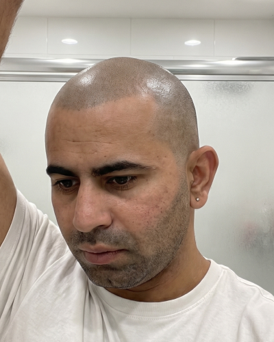 A man with a shaved head and a white t-shirt looks down and to his right.