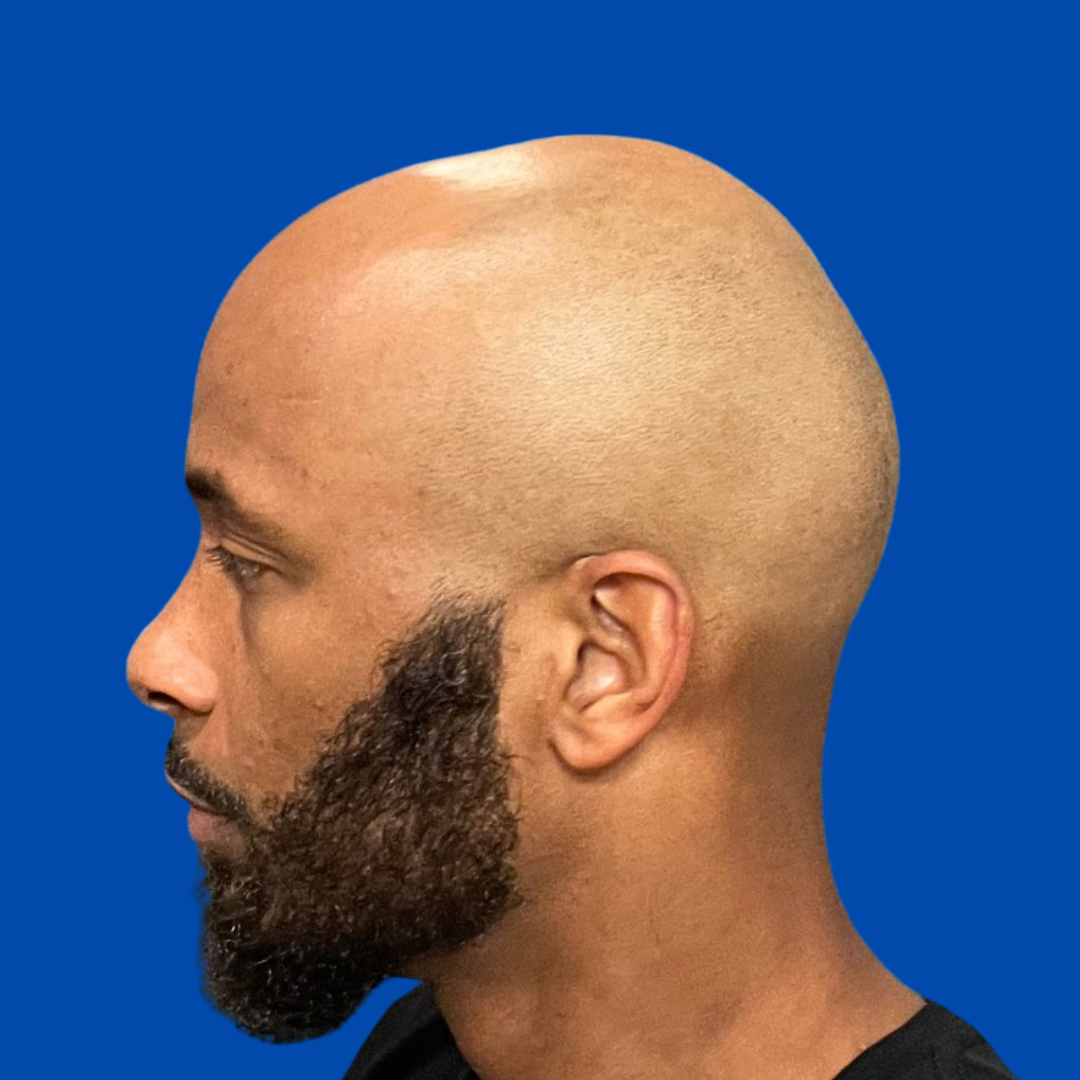 Profile of a bald man with a beard against a blue background.