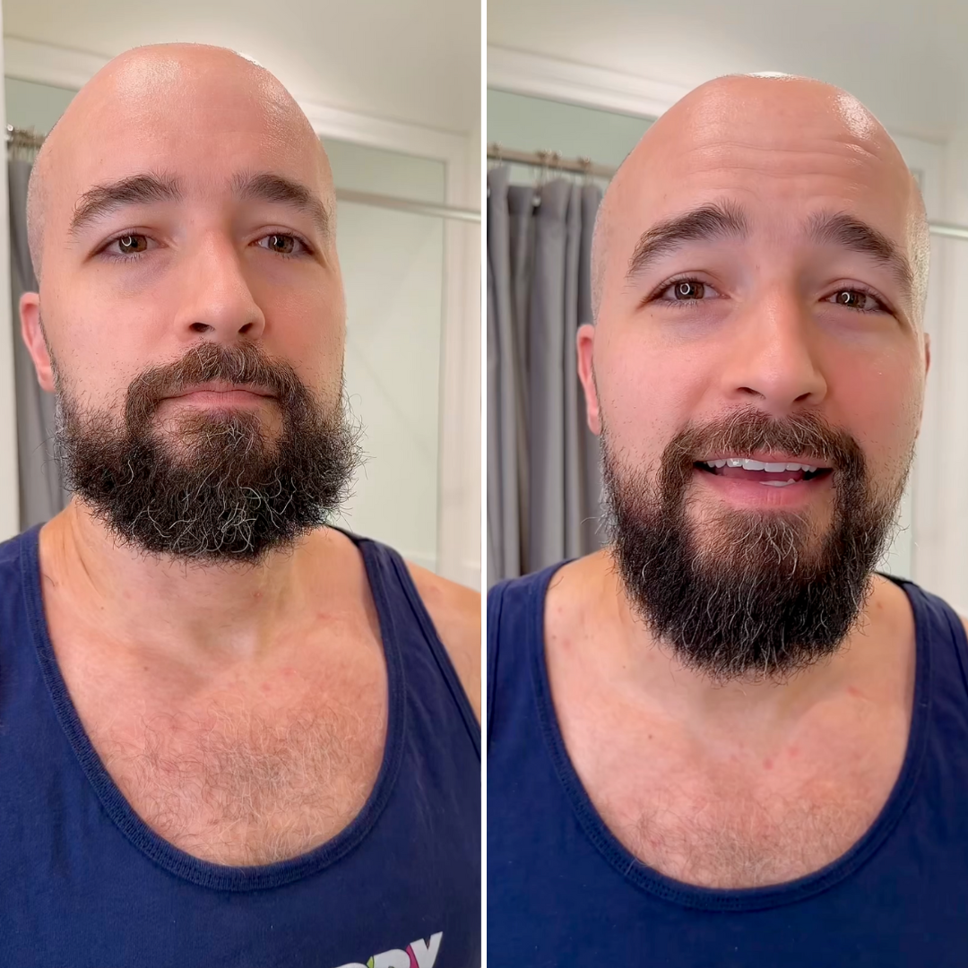 Bald man with a beard, before and after grooming, wearing a tank top.
