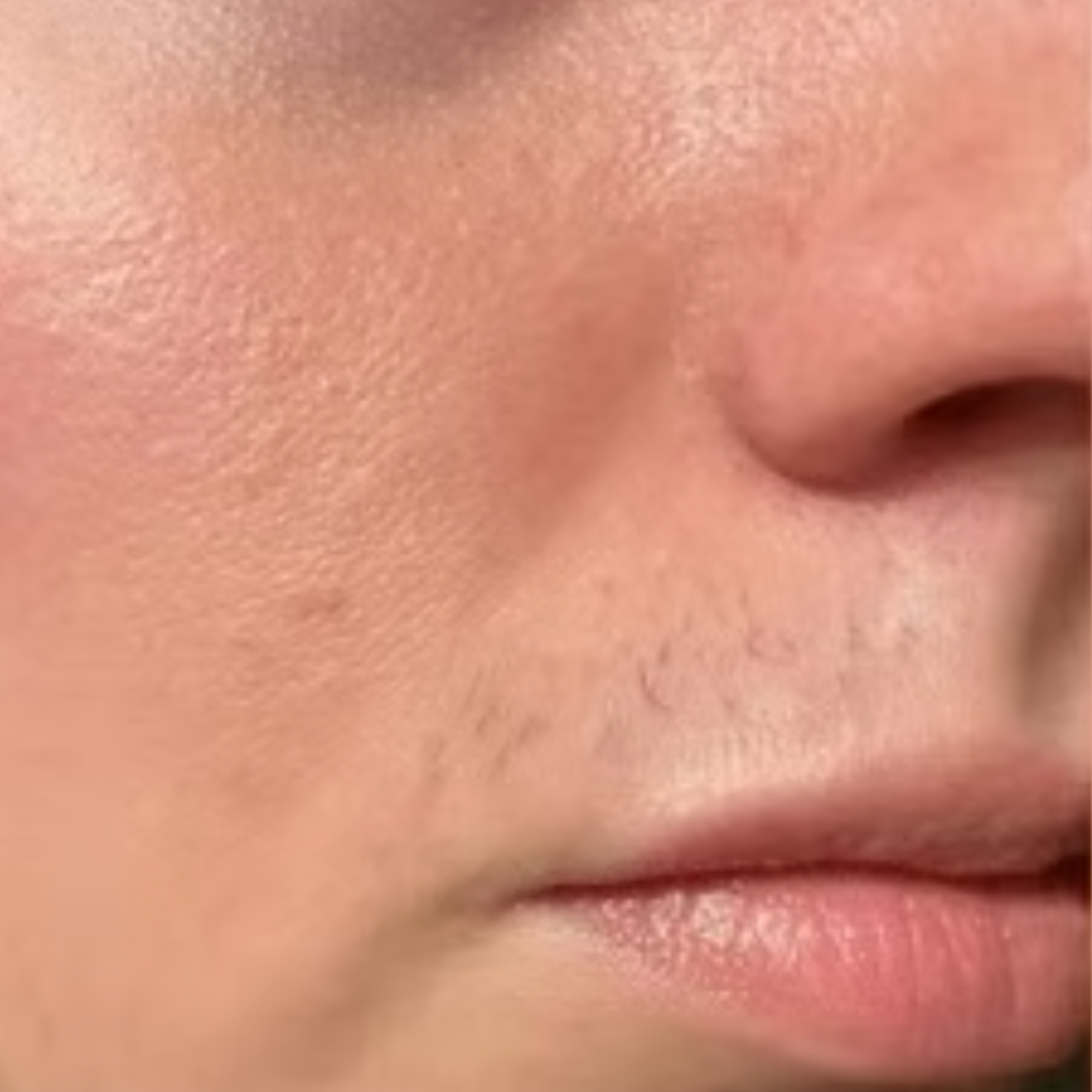 Close-up of a person's face showing skin texture and light facial hair.