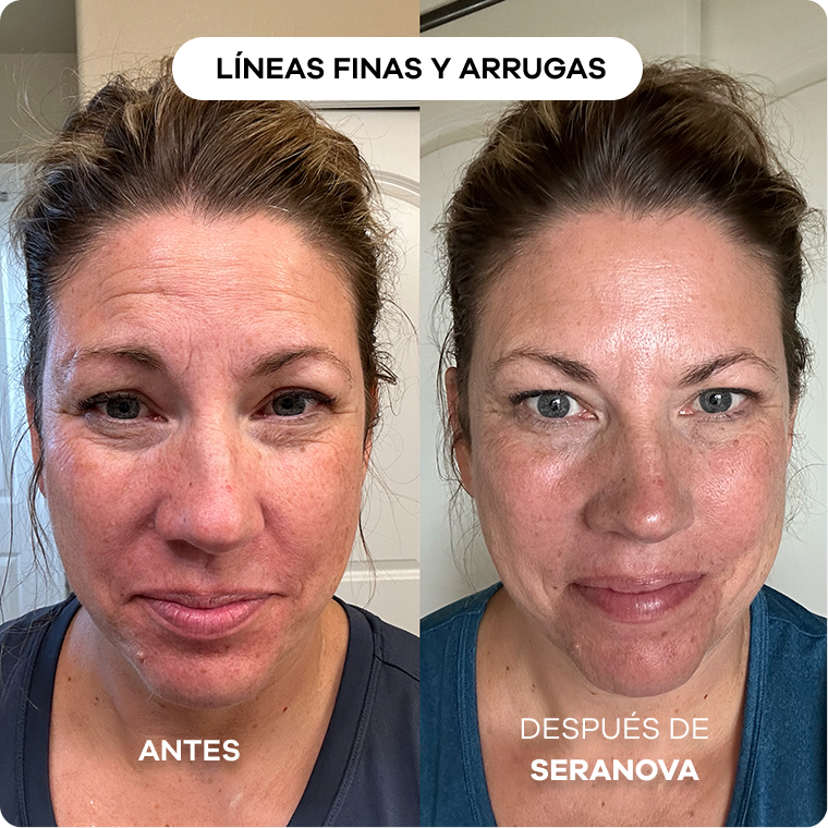 Side-by-side comparison of a woman's face before and after treatment.