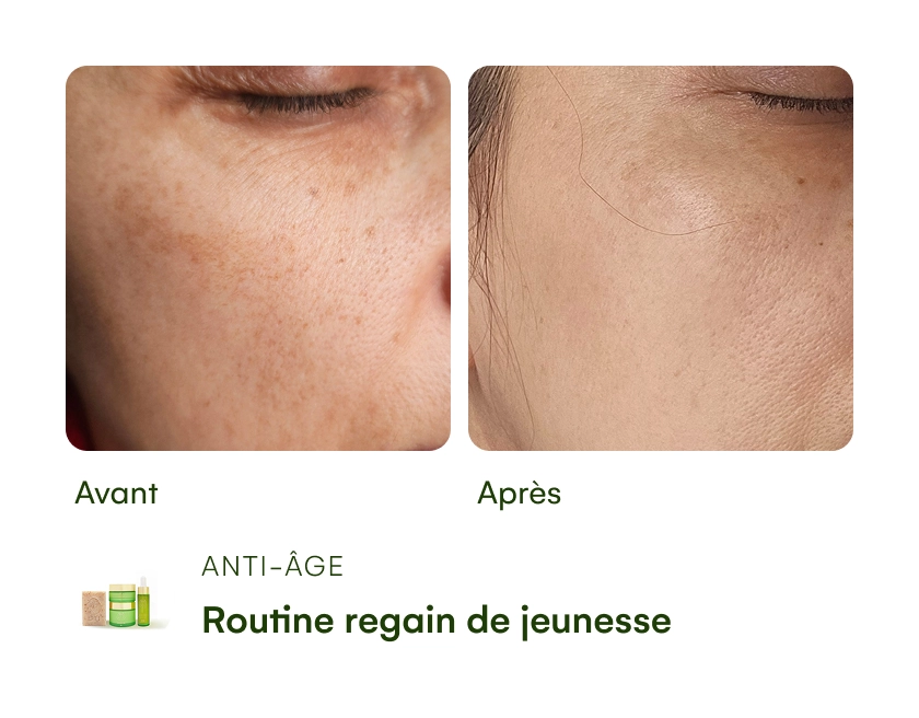 Comparison of skin texture before and after using an anti-aging product.