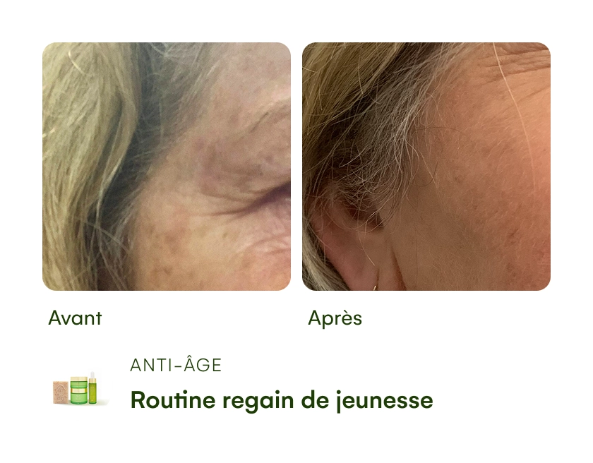 Before and after images of skin with anti-aging product text.