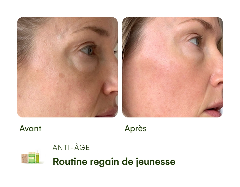 Before and after skincare comparison of a woman's cheek.