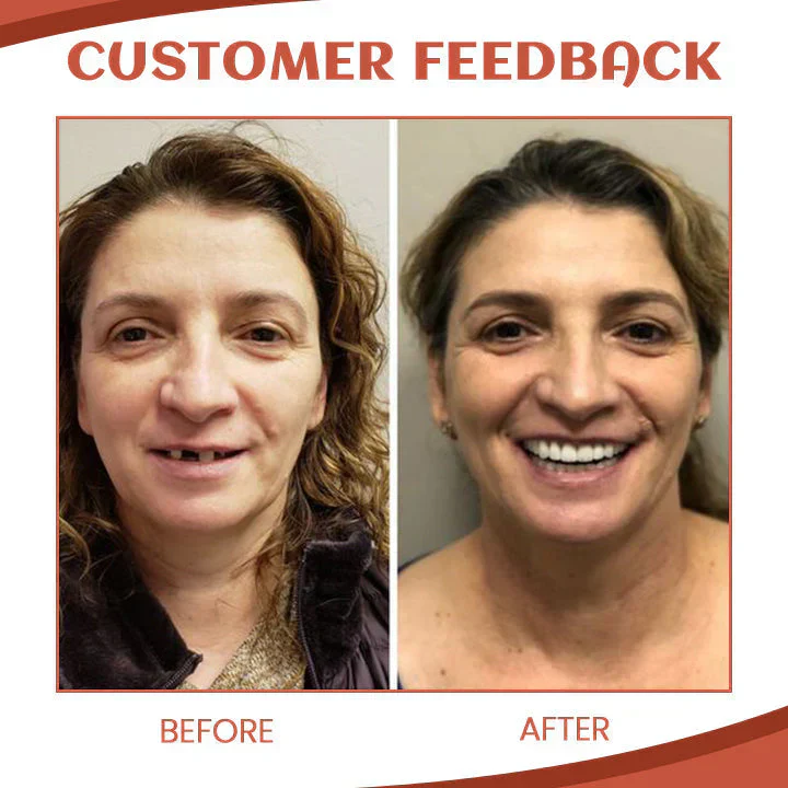 Side-by-side of a woman before and after a dental transformation.